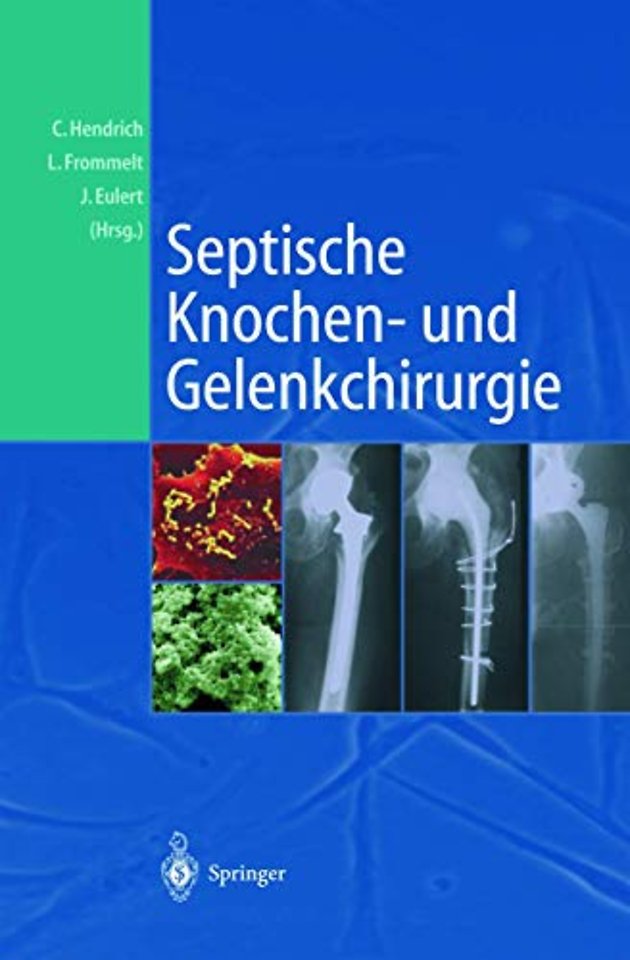 Septische Knochen-und Gelenkchirurgie