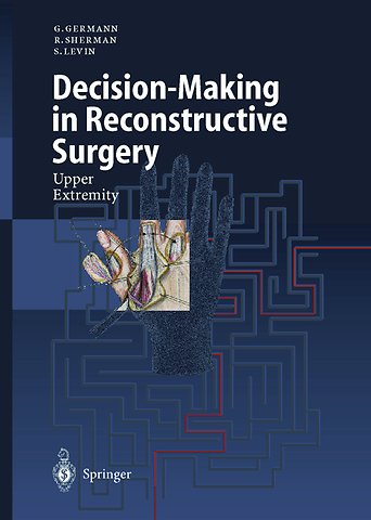 Decision-Making in Reconstructive Surgery