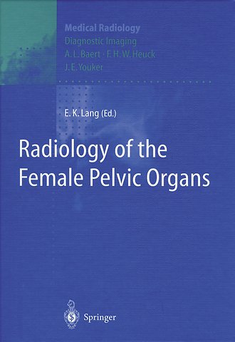 Radiology of the Female Pelvic Organs