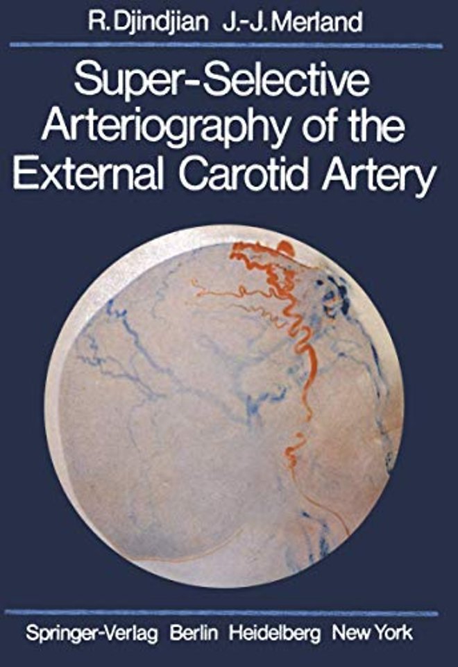 Super-Selective Arteriography of the External Carotid Artery