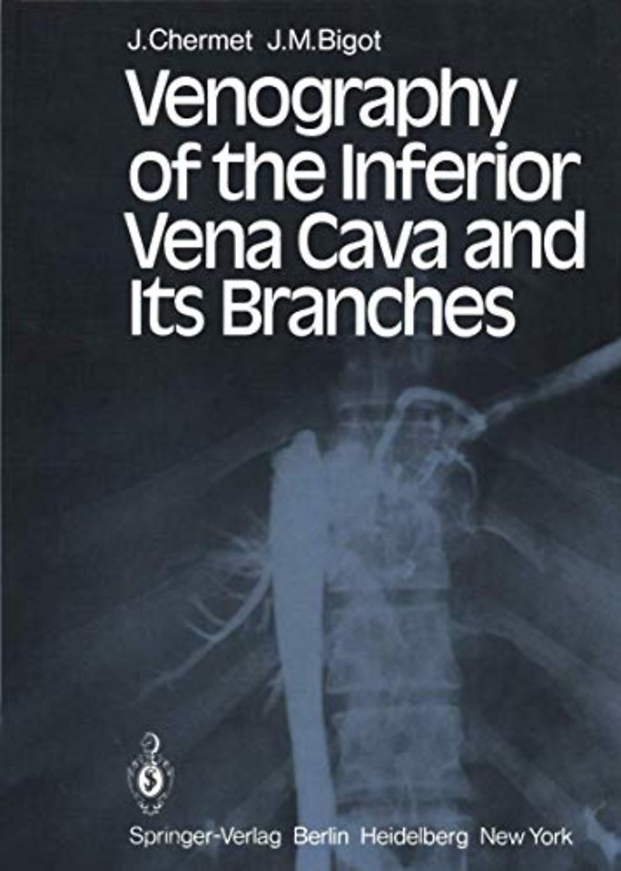Venography of the Inferior Vena Cava and Its Branches