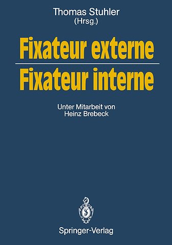 Fixateur externe — Fixateur interne