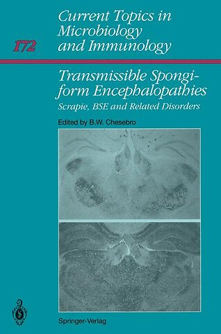 Transmissible Spongiform Encephalopathies: