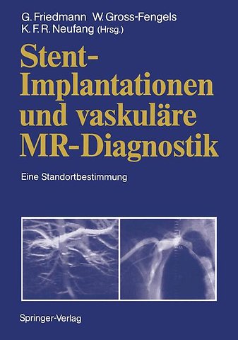 Stent-Implantationen und vaskuläre MR-Diagnostik