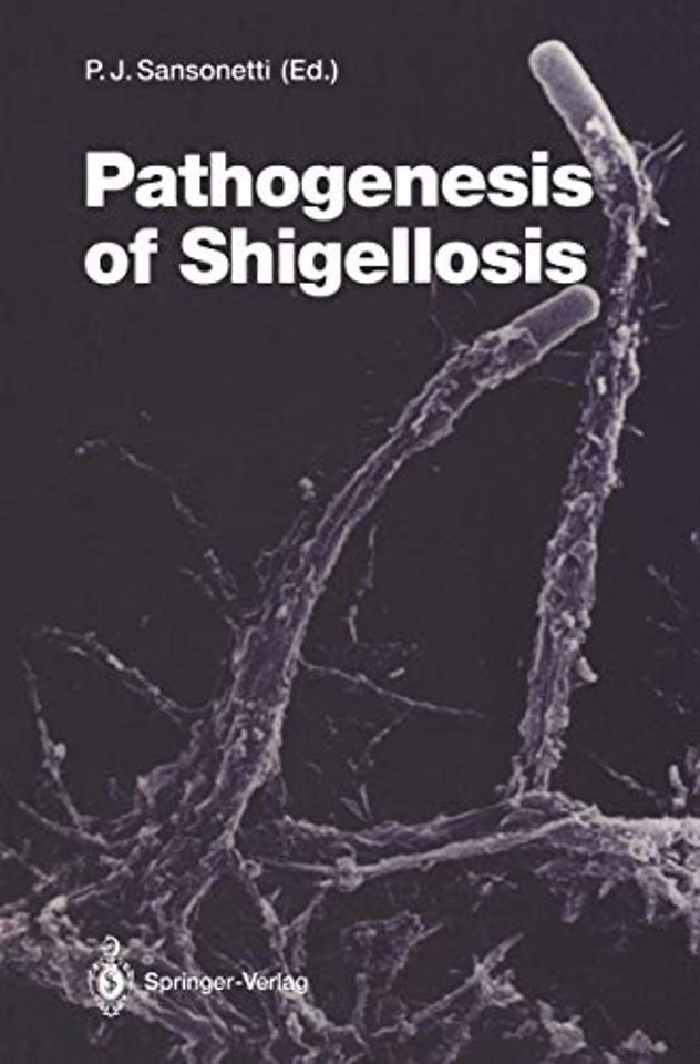 Pathogenesis of Shigellosis