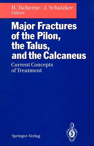 Major Fractures of the Pilon, the Talus, and the Calcaneus