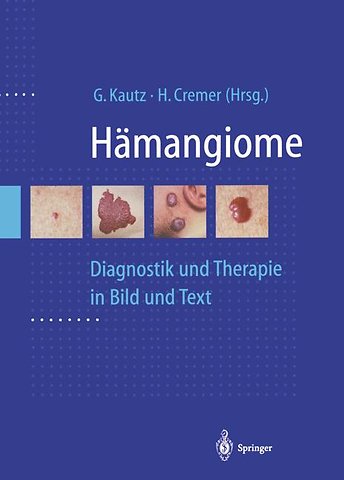 Hämangiome