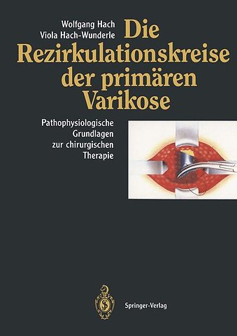 Die Rezirkulationskreise der primären Varikose