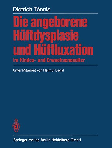 Die angeborene Hüftdysplasie und Hüftluxation im Kindes- und Erwachsenenalter