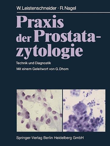 Praxis der Prostatazytologie