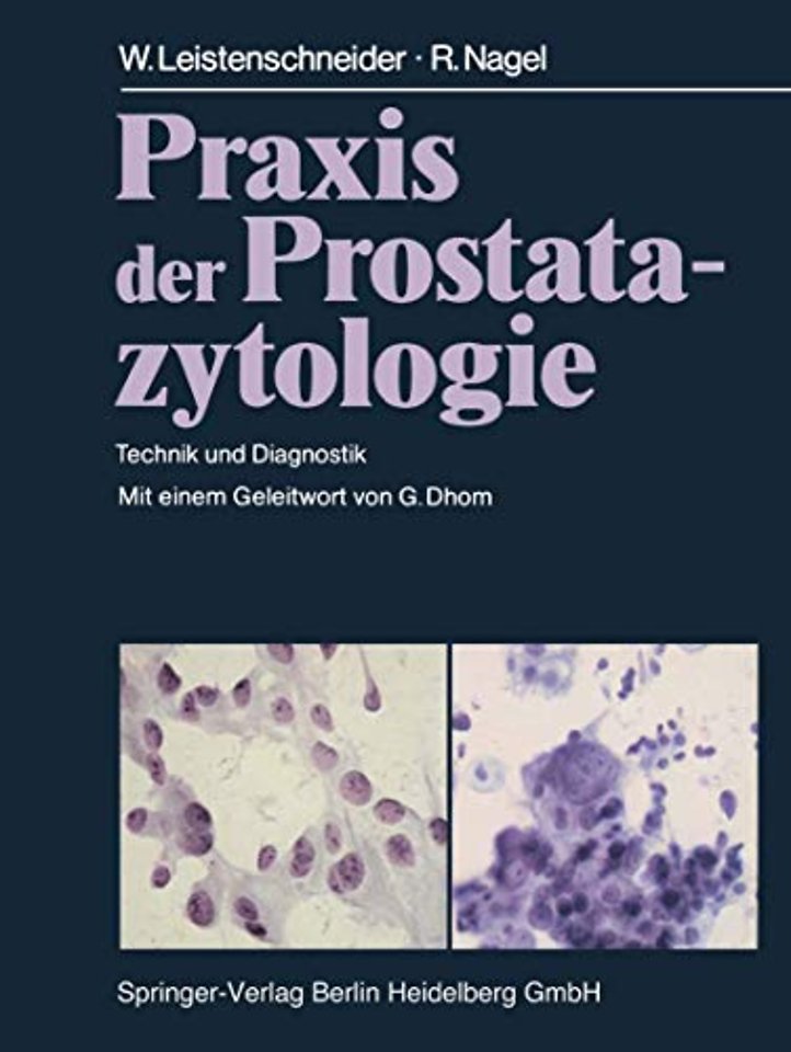 Praxis der Prostatazytologie