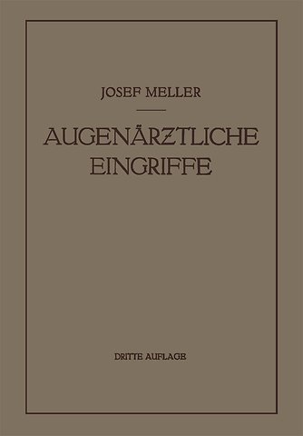 Augenärztliche Eingriffe