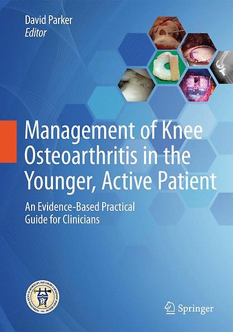 Management of Knee Osteoarthritis in the Younger, Active Patient