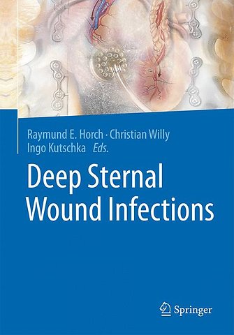 Deep Sternal Wound Infections
