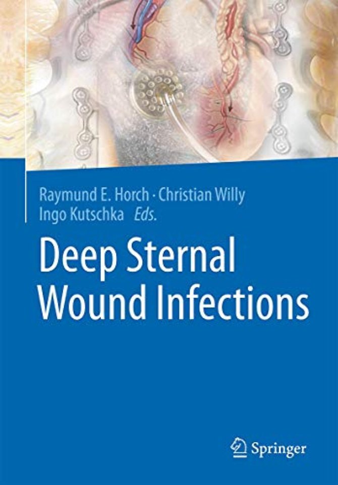 Deep Sternal Wound Infections