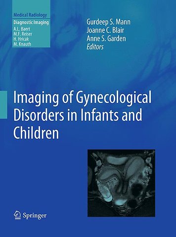 Imaging of Gynecological Disorders in Infants and Children