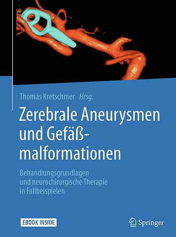 Zerebrale Aneurysmen und Gefäßmalformationen