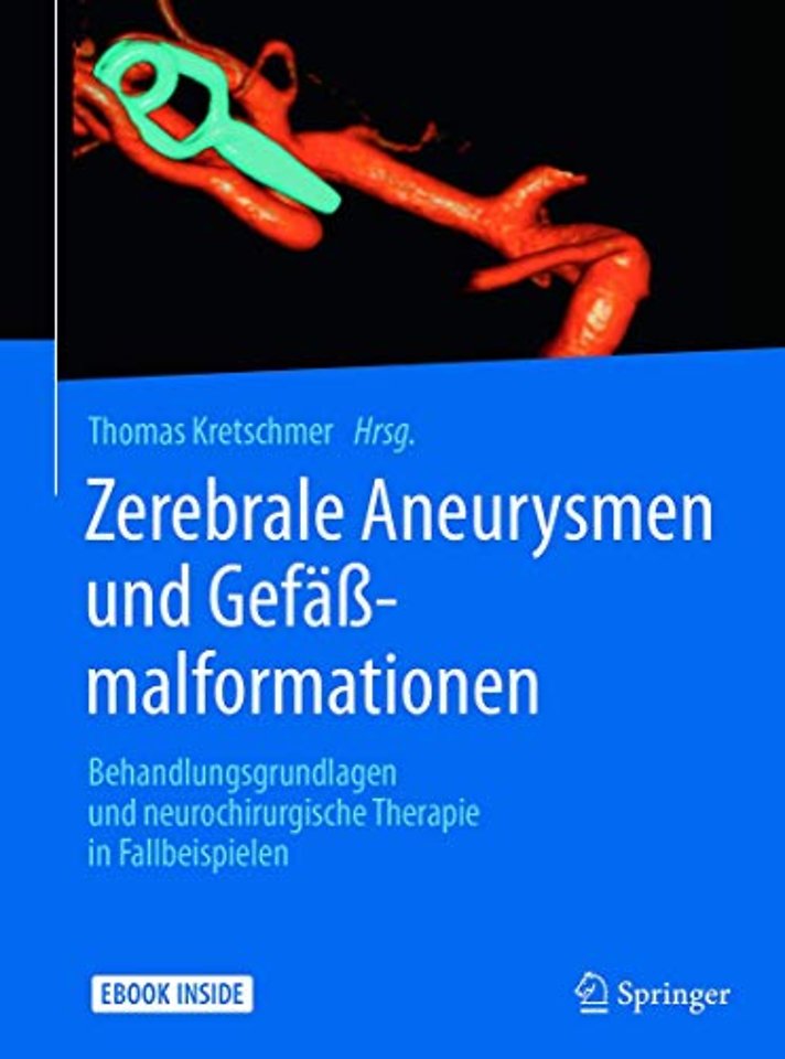 Zerebrale Aneurysmen und Gefäßmalformationen