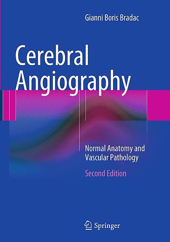 Cerebral Angiography