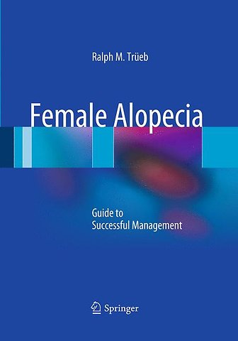 Female Alopecia