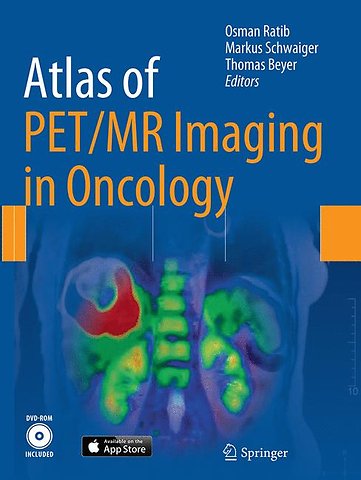 Atlas of PET/MR Imaging in Oncology