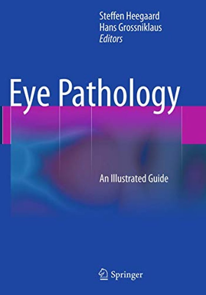 Eye Pathology