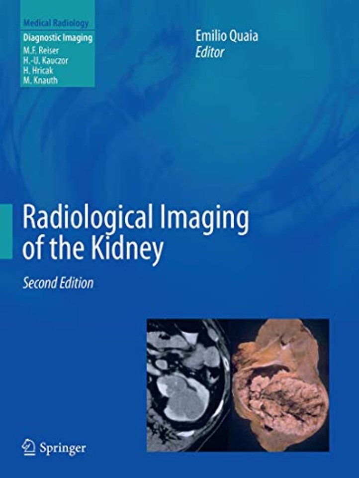 Radiological Imaging of the Kidney