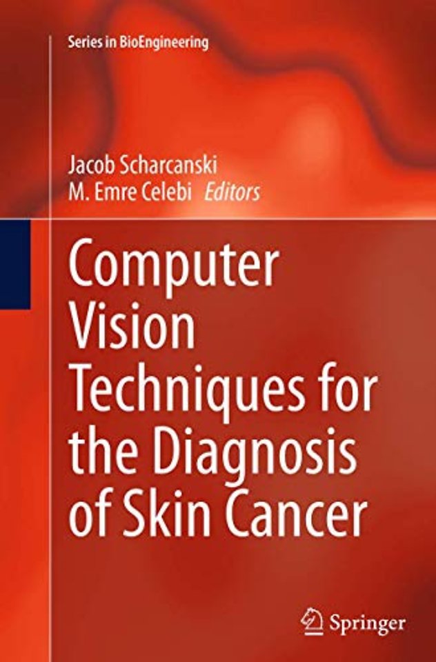 Computer Vision Techniques for the Diagnosis of Skin Cancer