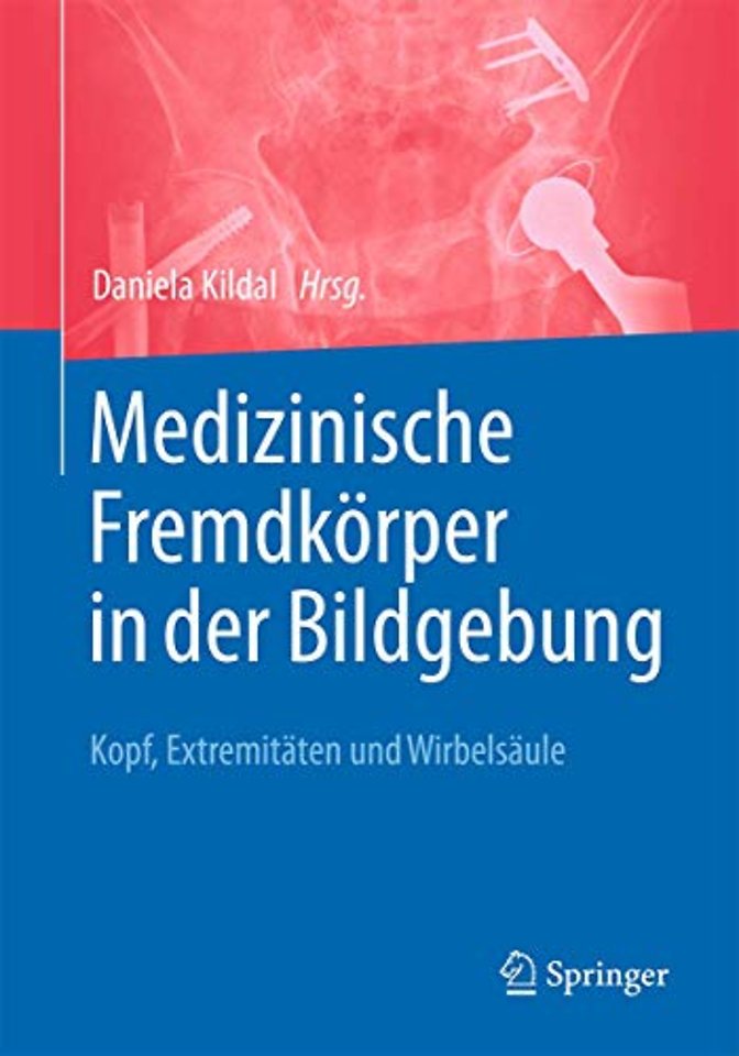 Medizinische Fremdkörper in der Bildgebung