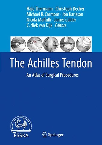 The Achilles Tendon