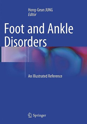 Foot and Ankle Disorders