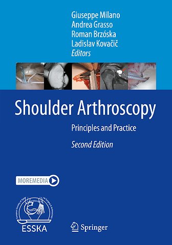 Shoulder Arthroscopy