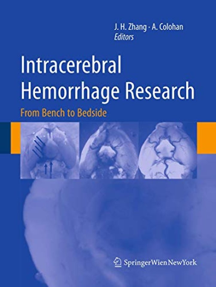 Intracerebral Hemorrhage Research