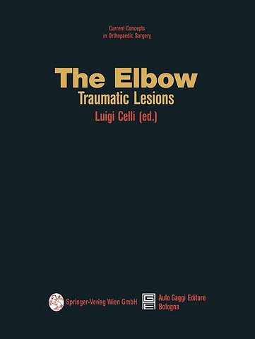 The Elbow