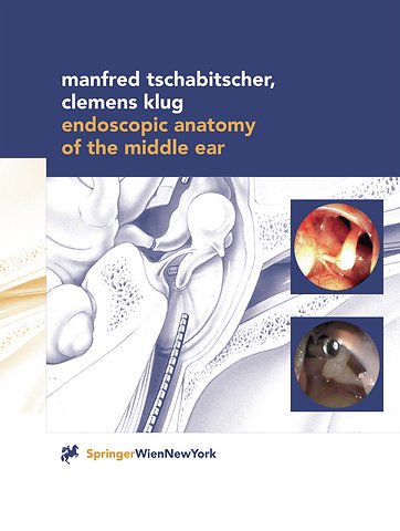 Endoscopic Anatomy of the Middle Ear