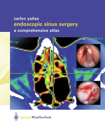 Endoscopic Sinus Surgery