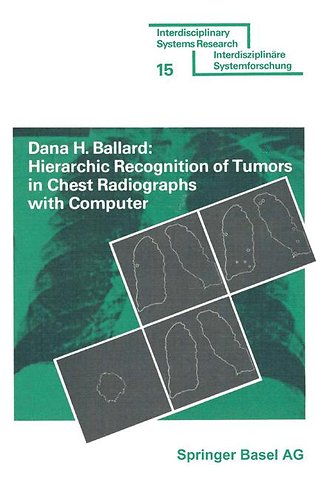 Hierarchic Recognition of Tumors in Chest Radiographs with Computer