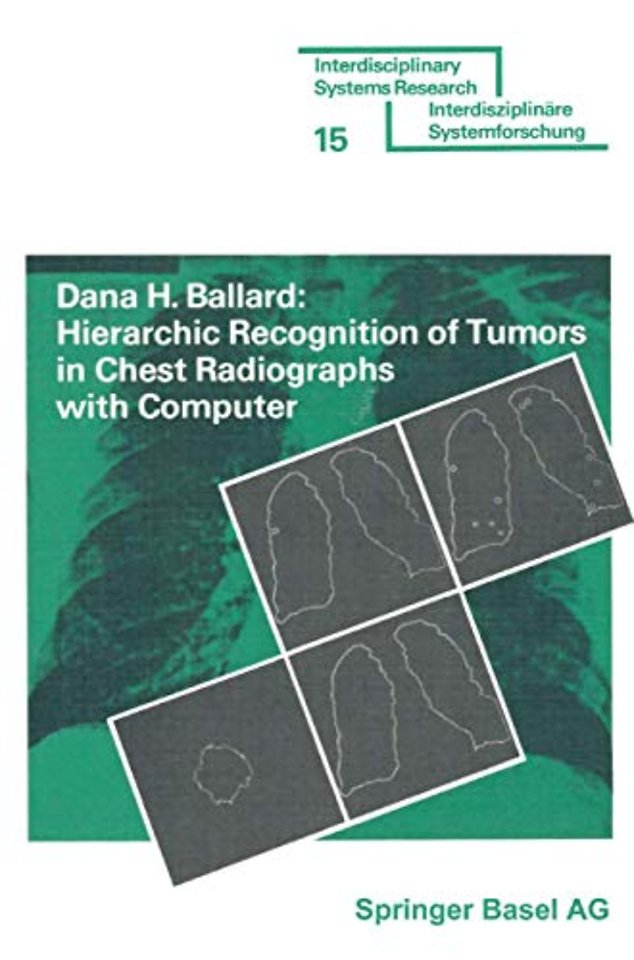 Hierarchic Recognition of Tumors in Chest Radiographs with Computer