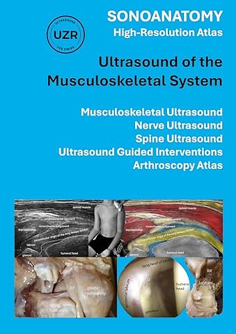 Sonoanatomy - High-Resolution Atlas - Ultrasound of the Musculoskeletal System
