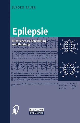 Epilepsie