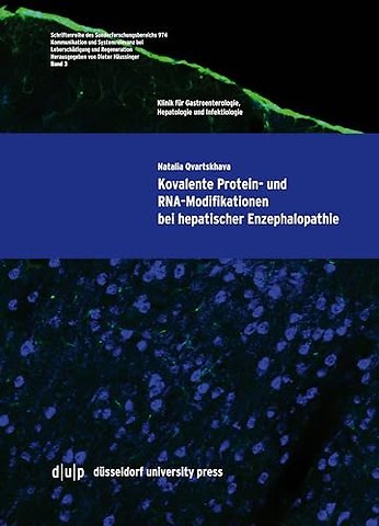 Kovalente Protein– und RNA–Modifikationen bei hepatischer Enzephalopathie