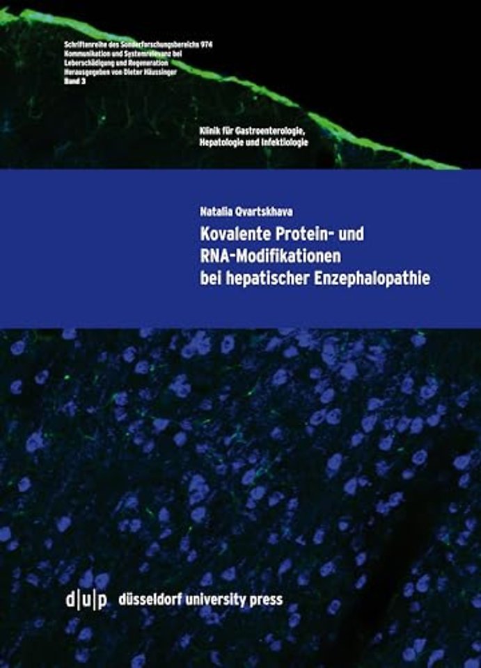 Kovalente Protein– und RNA–Modifikationen bei hepatischer Enzephalopathie