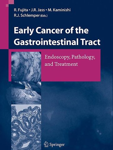 Early Cancer of the Gastrointestinal Tract