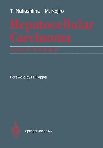 Hepatocellular Carcinoma