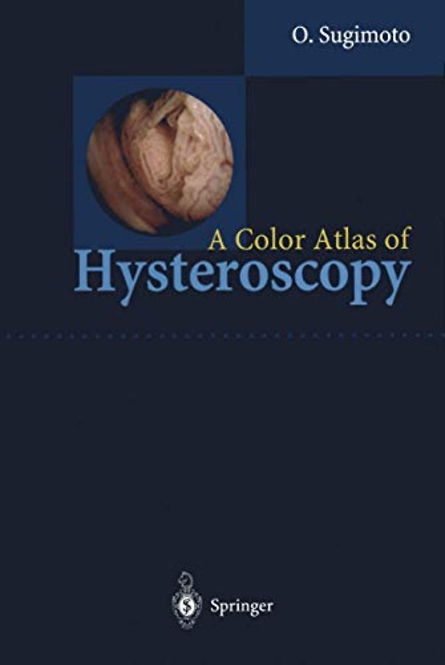 A Color Atlas of Hysteroscopy