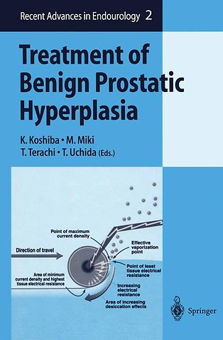 Treatment of Benign Prostatic Hyperplasia