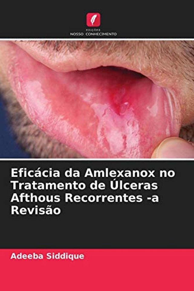 Eficacia da Amlexanox no Tratamento de Ulceras Afthous Recorrentes -a Revisao