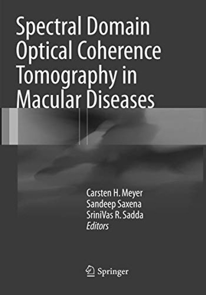 Spectral Domain Optical Coherence Tomography in Macular Diseases