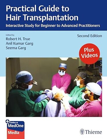 Practical Guide to Hair Transplantation – Interactive Study for Beginner to Advanced Practitioners