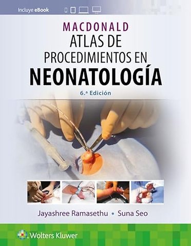 MacDonald. Atlas de procedimientos en neonatologia